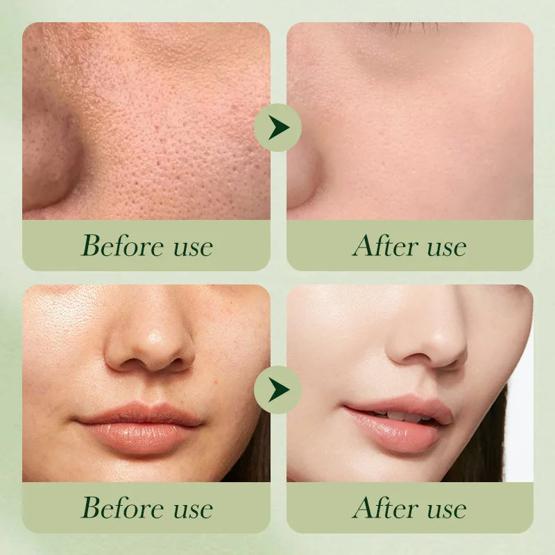 Avocado Skincare Set — Eye Cream, Face & Anti-Wrinkle, 6 Pcs