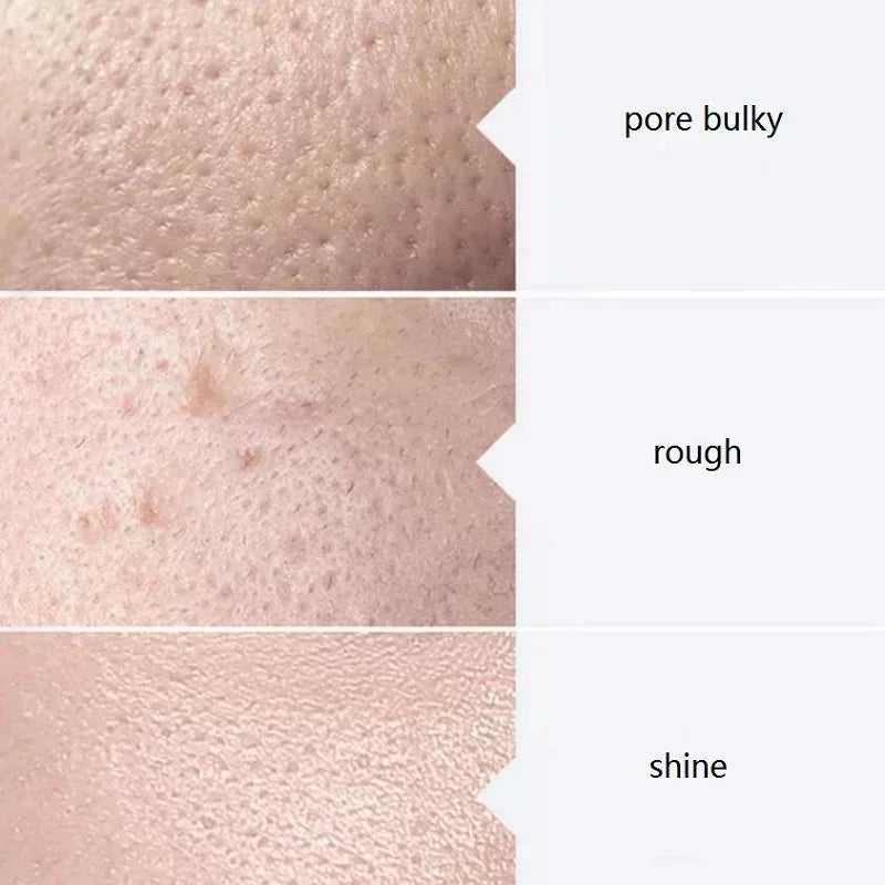 Aqua Peel Face Serum — AS1 SA2 AO3, 400ml (3-Pack)